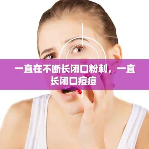 一直在不断长闭口粉刺,一直长闭口痘痘